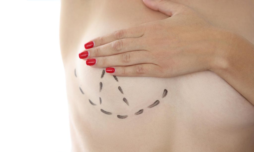 A Complete Guide to Breast Augmentation Surgery
